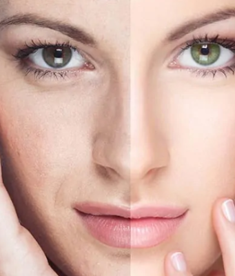 Перспективы омоложения организма фибробластами