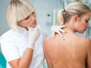 Почему нужно своевременно удалять папилломы?