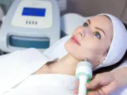 В чём преимущество RF-лифтинга?