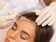 Мезотерапия для волос: что это, как работает и кому показана?