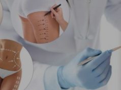 Пластическая хирургия: систематизация оперативных вмешательств по зонам тела