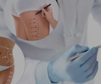 Пластическая хирургия: систематизация оперативных вмешательств по зонам тела