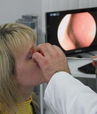 Эндоскопия носоглотки